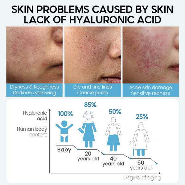 Hyaluronic Acid Face Serum Anti-Aging Shrink Pore Whitening Moisturizing Face Cream Dry Skin Care - Image 6